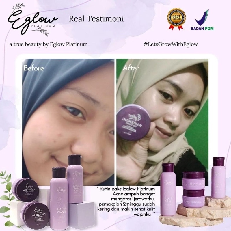 EGLOW PLATINUM PEMUTIH WAJAH PENGHILANG JERAWAT PENGHILANG FLEK KUSAM EGLOW ORIGINAL EGLOW BPOM PAKET WHITENING ACNE ULTIMATE