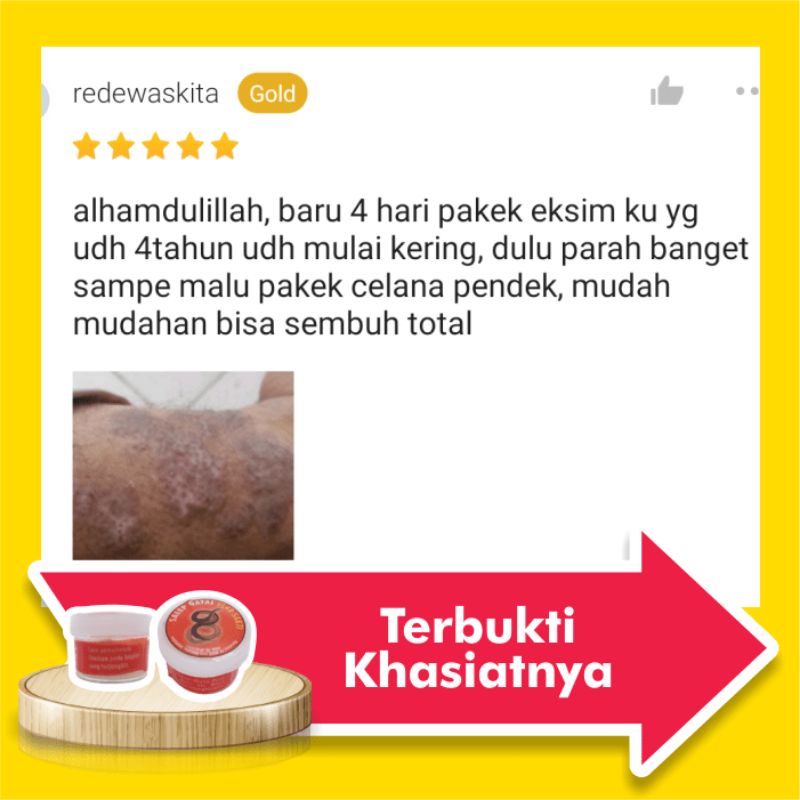 Obat Salep Gatal Eksim Kering Menahun Paling Ampuh Kulit Gatel Basah Selangkangan Kurap Kutu Air Luka Diabetes Panu Kudis Kadas-4