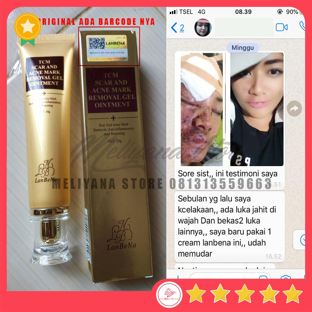 Penghilang Bekas Luka TCM LANBENA Scar and Acne Mark Removal Gel Ointment