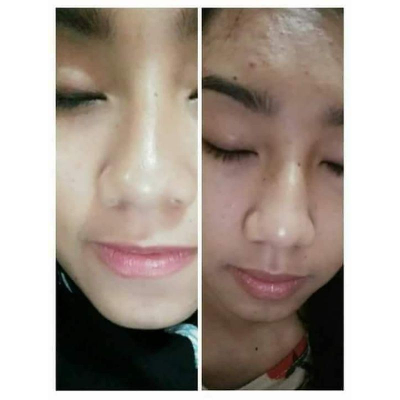 moreskin serum emas