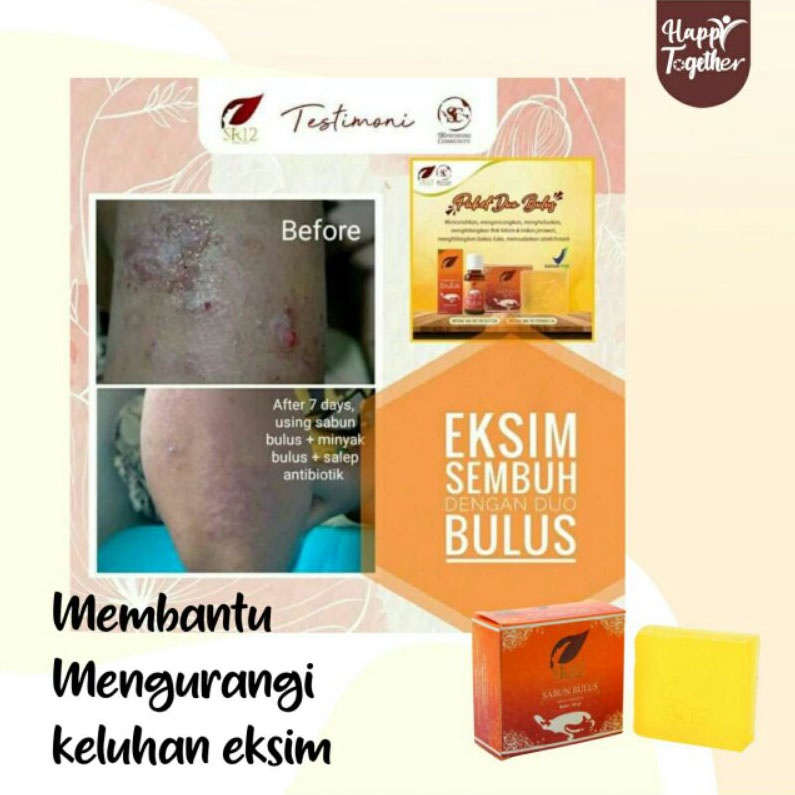 Sabun Bulus SR12 Pembersih Wajah Serbaguna Untuk Gatal Selangkangan Eksim Penghilang Bekas Luka Strechmark Jerawat Herbal Soap Pembesar Payudara 60gr