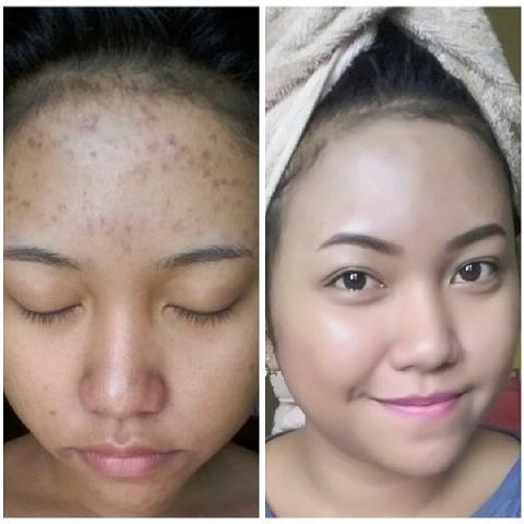 SAFRON FACE MIST SAFFRON GLOWING FACE MIST BPOM 100ml SH PENCERAH WAJAH PENGHILANG BEKAS JERAWAT