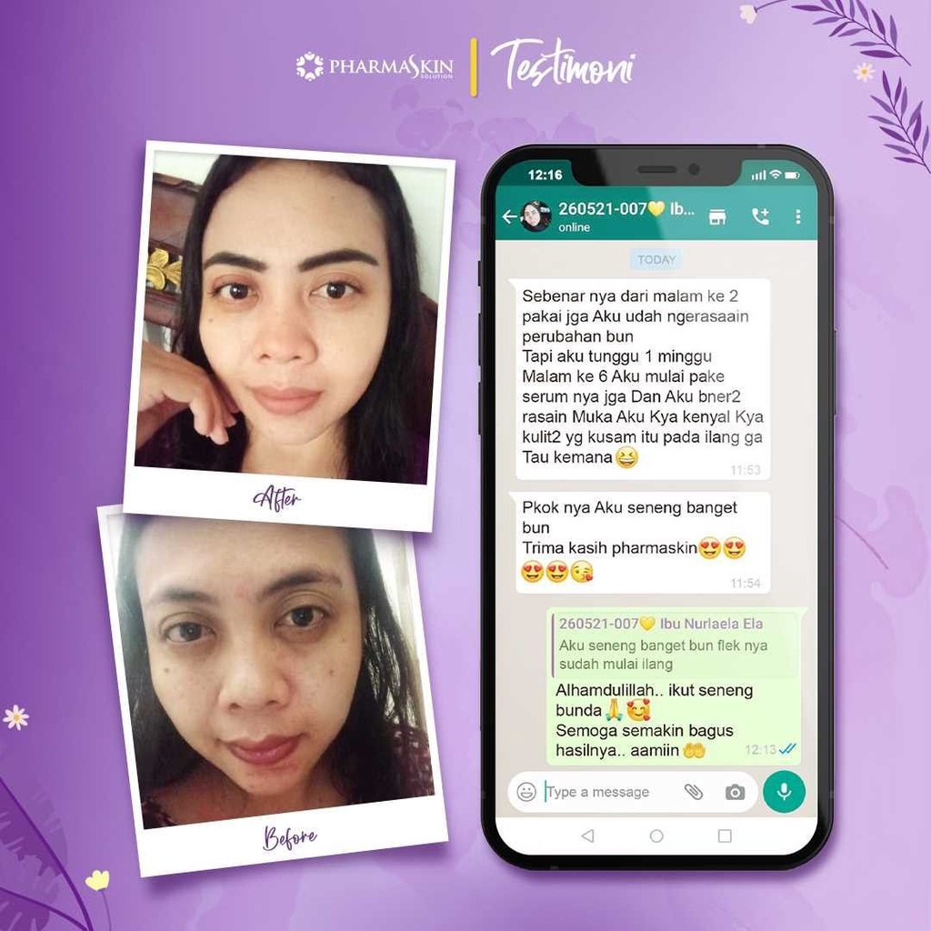Pharmaskin Paket Full Treatment Acne Glowing Series Bebas Menghilangkan Jerawat Perawatan Wajah Berjerawat Glowing Ampuh Resmi BPOM Halal Original-4