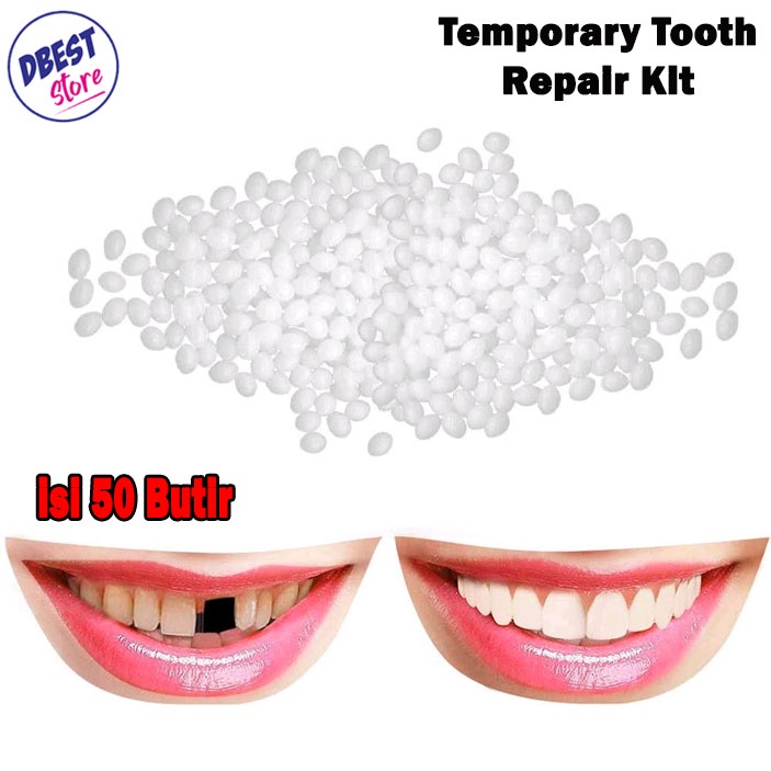 DBEST - [PAKET 50 BUTIR] Gigi Palsu / Temptooth Lem Tambal Gigi Ompong Patah dan Berlubang / Temporary Tooth