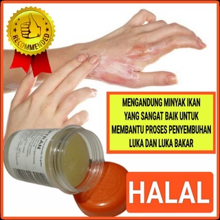 Jual Salep Minyak Ikan Obat Luka Bakar Tersiram Air Panas Minyak Panas ...