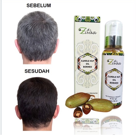 ZIVAA CANDLE NUT OIL BORNEO PENGHILANG UBAN/ANTI UBAN/PENGHITAM RAMBUT UBAN PERMANEN