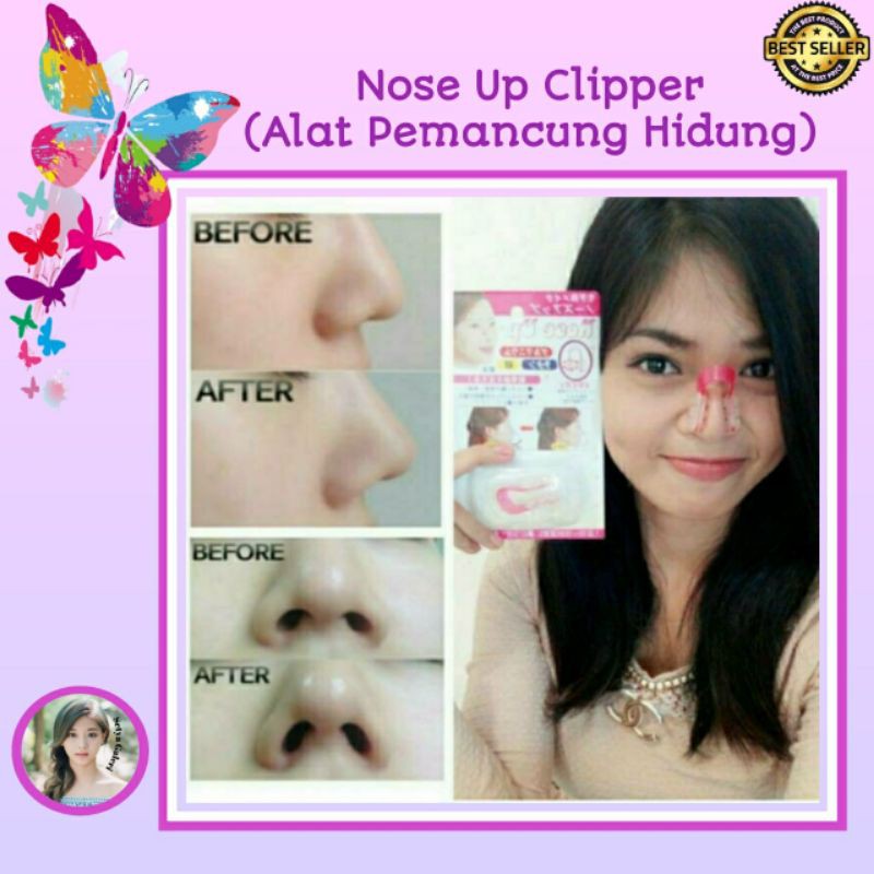 Pemancung Hidung Aman Untuk Memancungkan Hidung - NOSE UP Clipper Berbahan Silicon Nyaman Dipakai