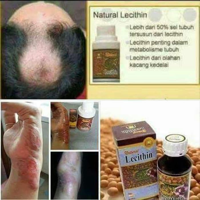 OBAT HERBAL PENYAKIT KULIT, LECITH MINYAK KEDELAI 100 ML NASA