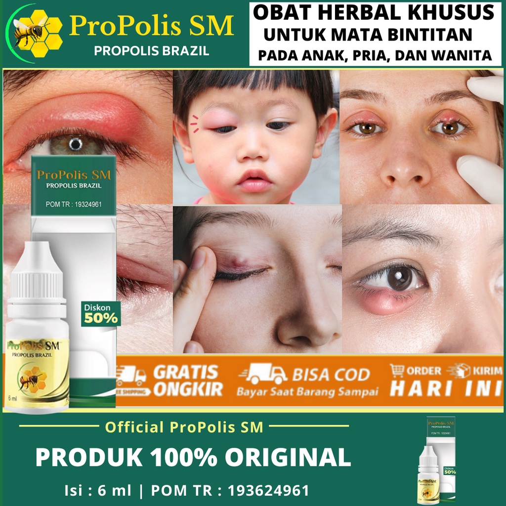 obat-bintitan-mata-homecare24