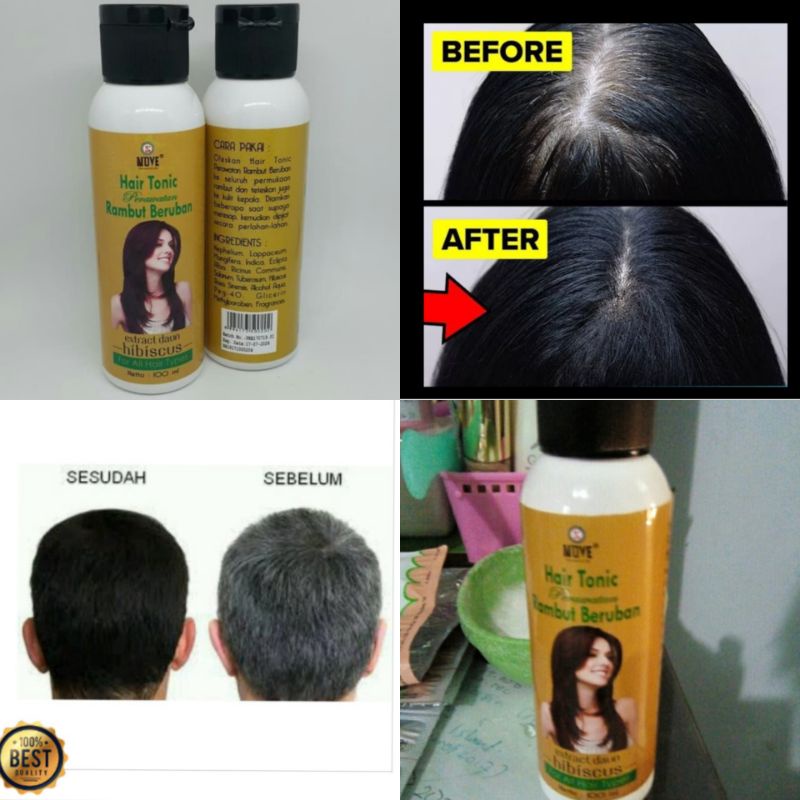 NVE Tonic Khusus Rambut Uban Rambut Bajang Rambut Putih Tonik Rambut Beruban memanjangkan rambut Nut