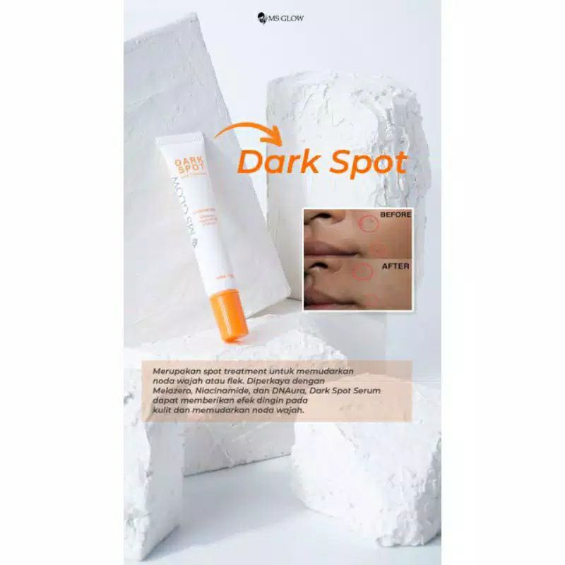 SPOT TREATMENT By MS GLOW