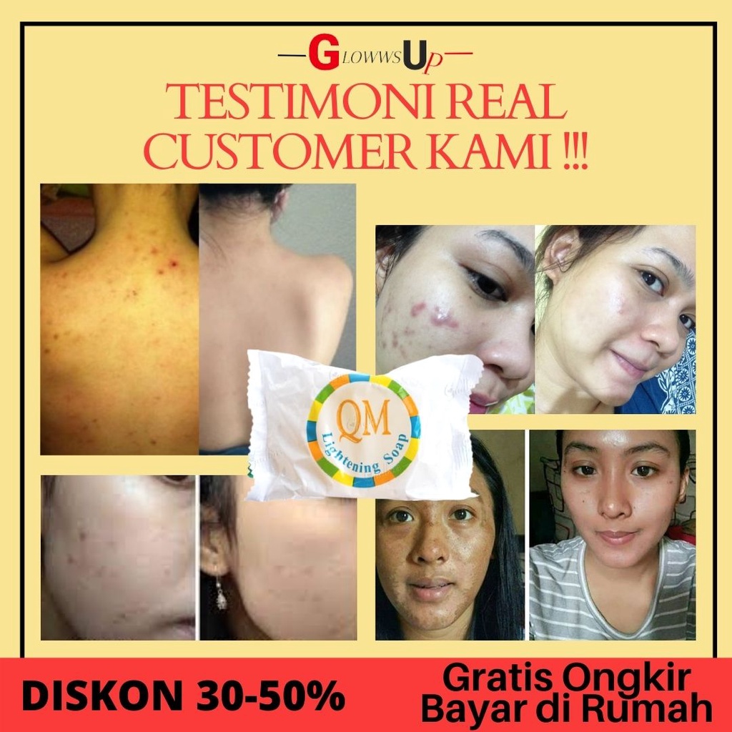 SABUN PENCERAH WAJAH QM BRIGHTENING SOAP SABUN WAJAH PEMUTIH WAJAH SABUN PEMUTIH WAJAH SABUN PEMUTIH SABUN BATANG SABUN BATANGAN