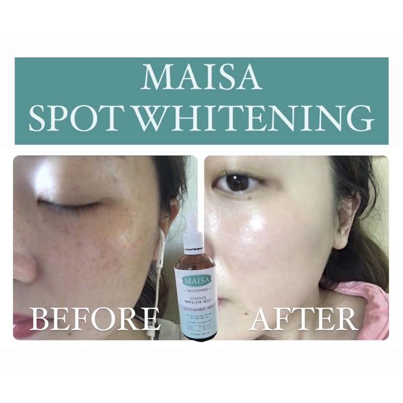 MAISA SPOT WHITENJNG ESSENCE