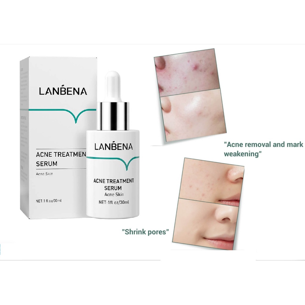 [BPOM] LANBENA Serum [ Vitamin C | Hyaluronic Acid | Acne ]