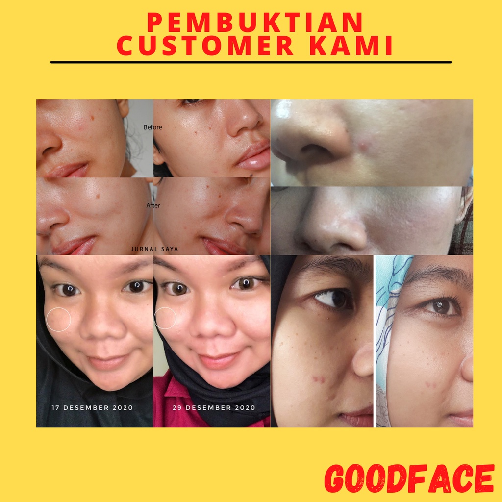 PELEMBAB WAJAH BERMINYAK SERUM WAJAH SOMETHINC 3% Asthaxanthin + Chlorelina Serum