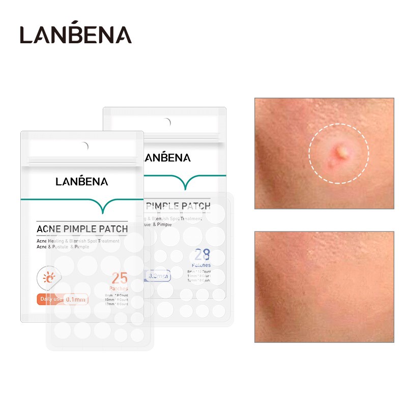 {LB} LANBENA Acne Pimple Patch Masker Invisble Stiker Jerawat