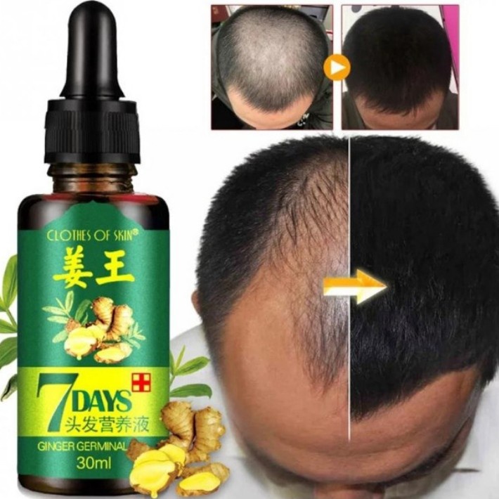 OBAT PENUMBUH RAMBUT BOTAK SERUM PENUMBUH RAMBUT KEPALA