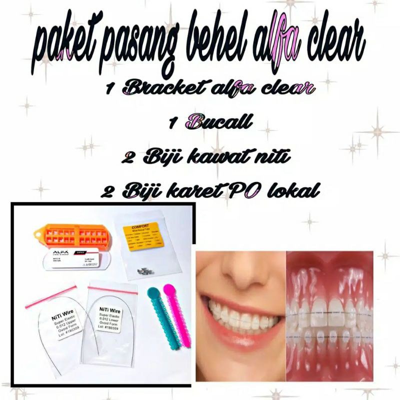 

Behel Permanen Alfa Clear bening