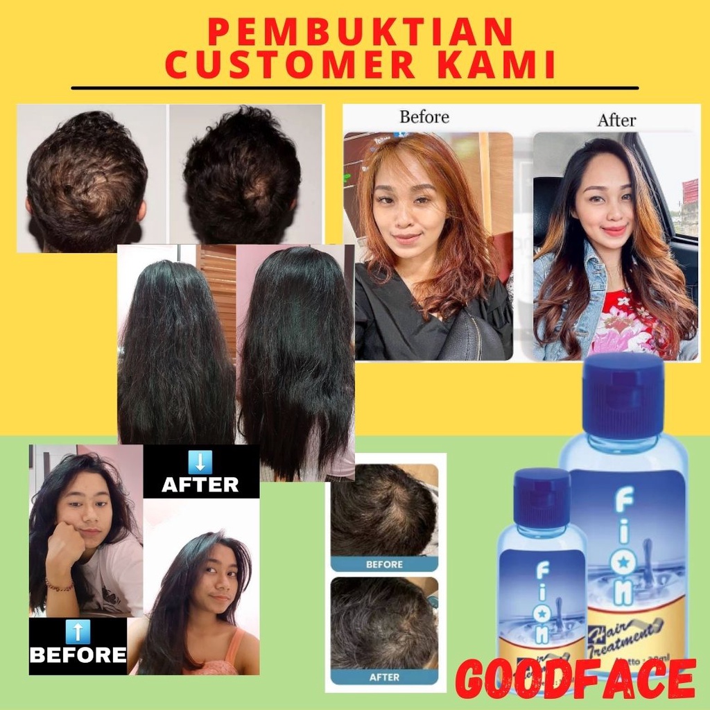 VITAMIN RAMBUT RONTOK - FION HAIR TREATMENT 30ML ORIGINAL BPOM - VITAMIN RAMBUT FION 30ML