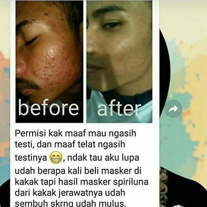 Berapa hari perubahan masker spirulina