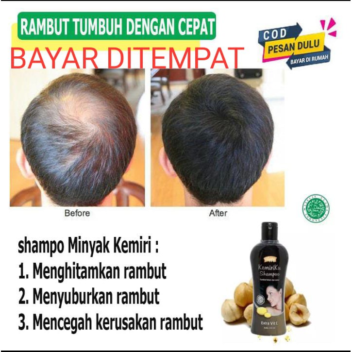 SHAMPO  KEMIRIKU AMPUH MENGHILANGKAN UBAN  100%ORIGINAL BPOM