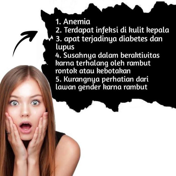 ♬ TOP NO 1 SERUM PENUMBUH RAMBUT ALFURA [ BISA ] ●