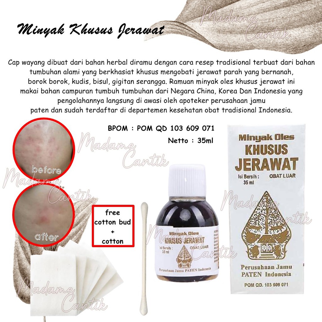 ✿ MADAME ✿ WAYANG OBAT JERAWAT / MINYAK PENGEMBUH JERAWAT