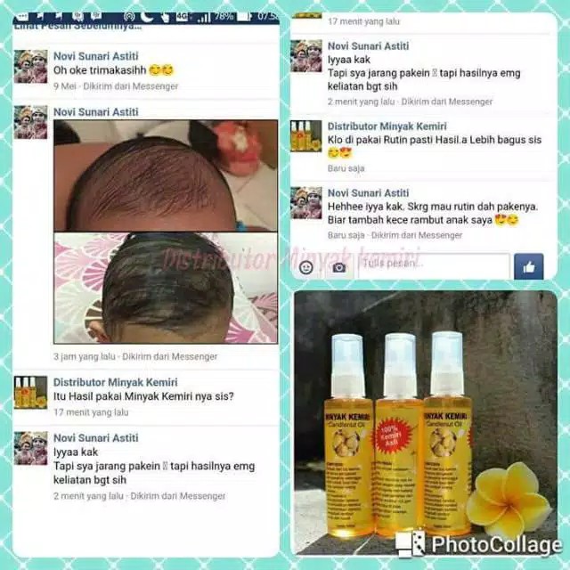 Minyak Kemiri Asli Original Penumbuh Rambut Bayi Rambut Botak Rontok Shopee Indonesia