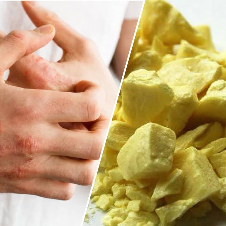 Belerang Sulfur Herbal 1Kg -Belerang Kuning Untuk Obat Kulit & Jerawat