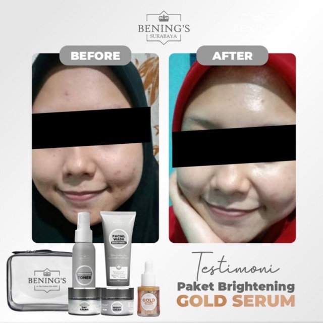 BENING'S PAKET BRIGHTENING | MENCERAHKAN DAN MENGATASI KULIT KUSAM