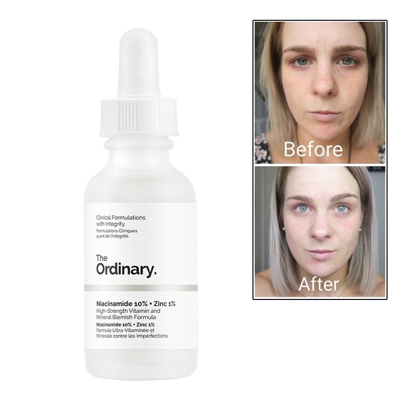 The Ordinary Niacinamide 10% + Zinc 1% Serum Wajah The Ordinary Serum Niacinamid Serum 30ml