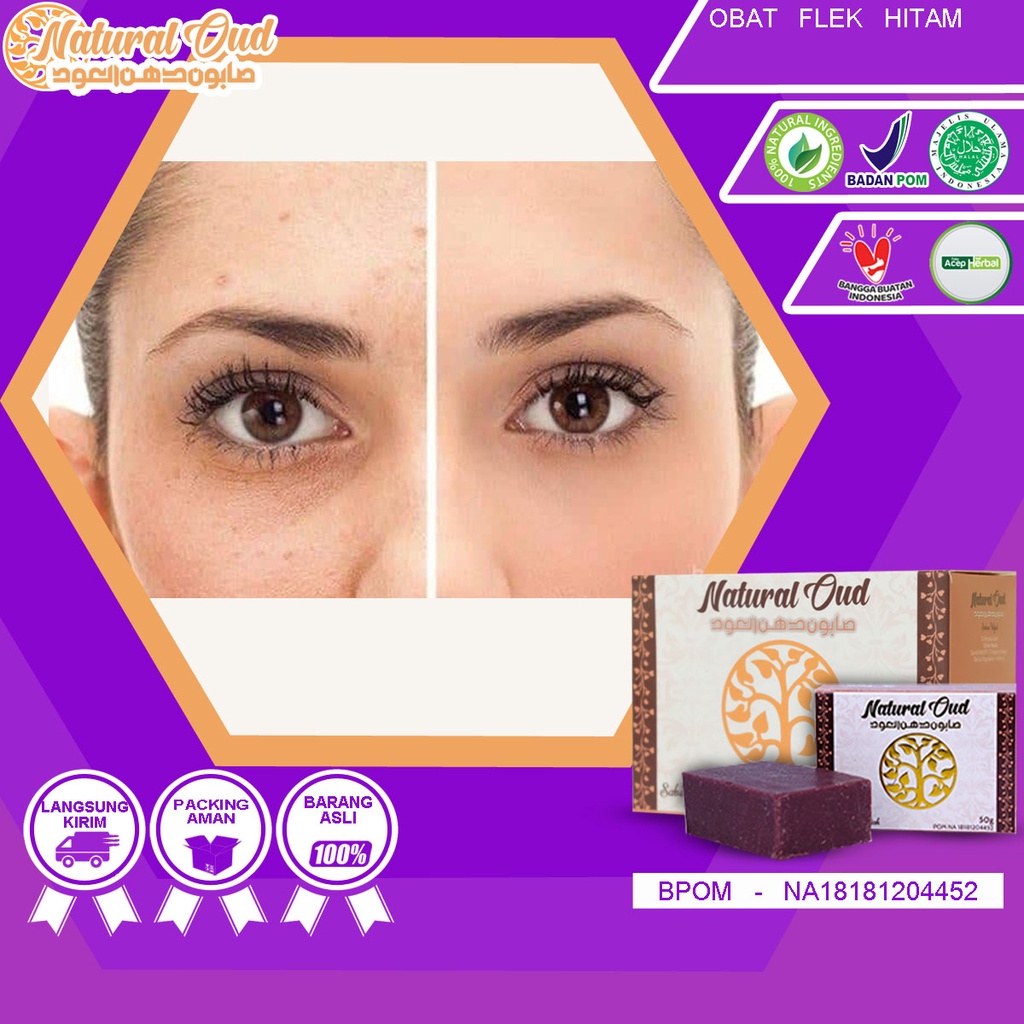 Sabun Wajah Natural OUD - Obat Flek Hitam
