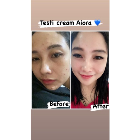 AIORA SKINCARE BPOM CREAM WAJAH PAKET GLOWING ACNE-3