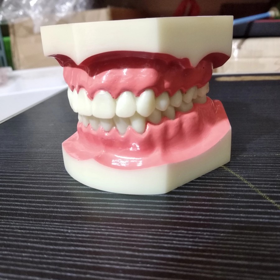 Dental Study Model Gigi Tidak bisa Dilepas Phantom Gigi Kualitas bagus
