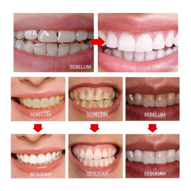 BREYLEE TEETH WHITENING POWDER &amp; PEN PEMUTIH GIGI