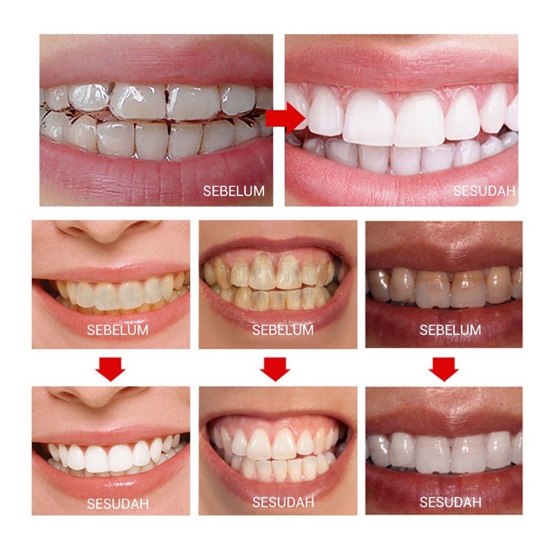 [READY LANGSUNG KIRIM] BREYLEE Teeth WHITENING POWDER / odol pemutih gigi dan karang gigi pembersih gigi