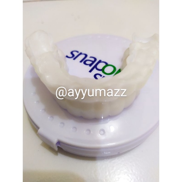 Veneer Gigi Snap On Smile Asli Original Helm Pelindung Gigi Palsu Memutihkan Mempercantik Gigi