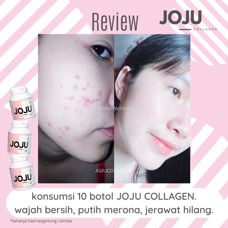 Joju Collagen Primerose Thailand Indonesia