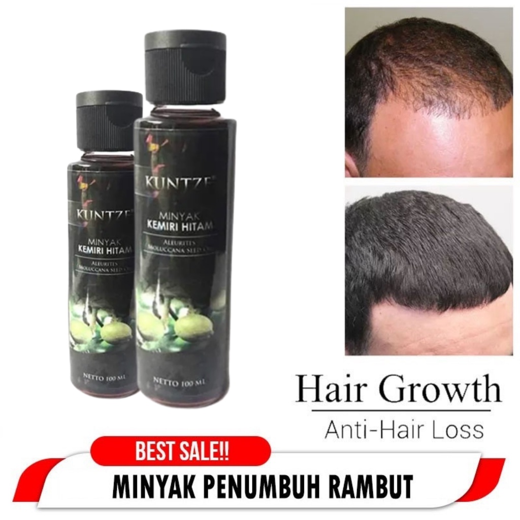 100ml Minyak Kemiri Hitam Murni 𝐎𝐑𝐈𝐆𝐈𝐍𝐀𝐋 / Penumbuh Rambut Botak Rontok / Penumbuh Brewok KUNTZE