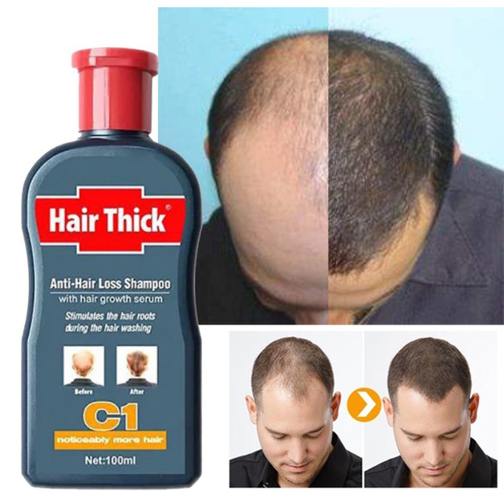 Fast Hair Growth Essence Serum Repair Damaged Coarse Anti Hair