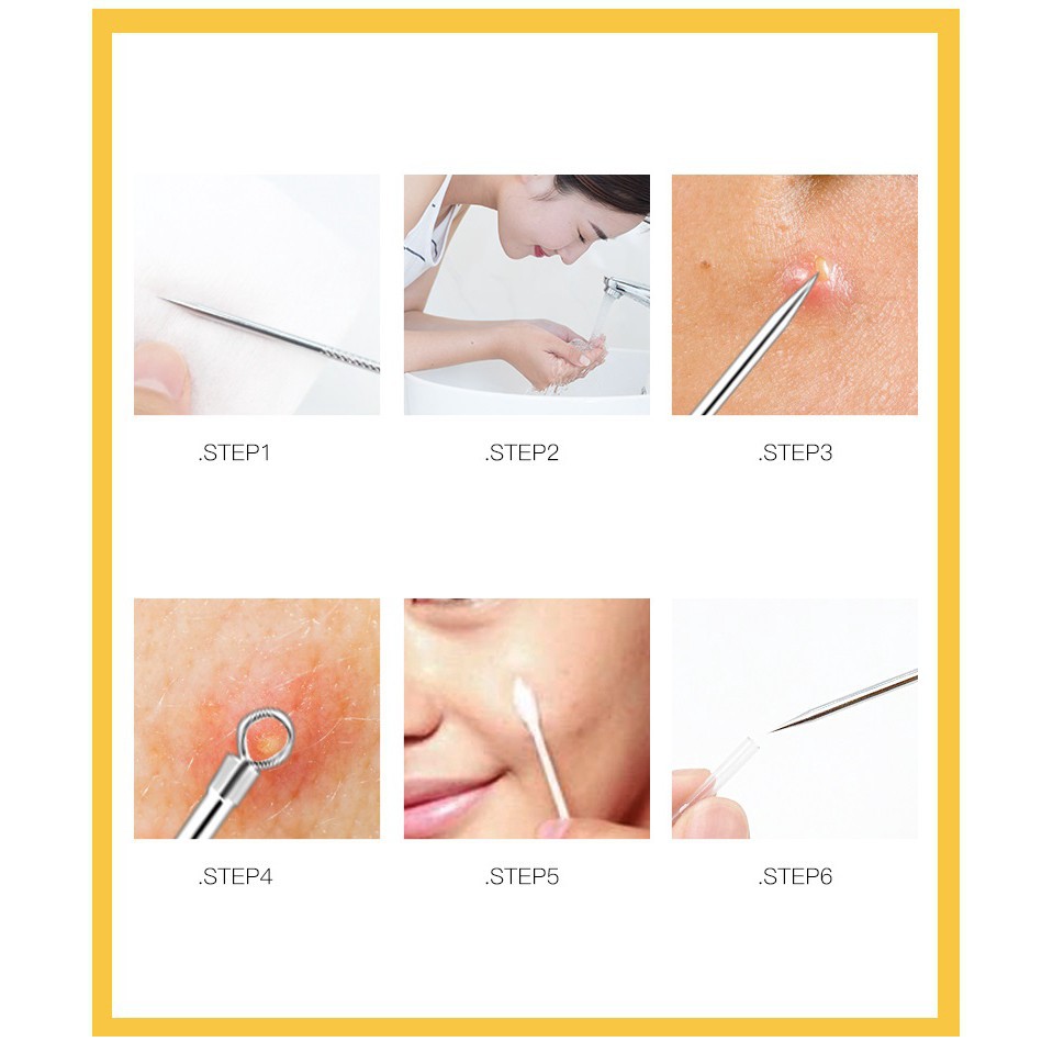 HL0140 Alat Pencet Jerawat Komedo Set 4 In 1 Pinset Jerawat Pembersih Blackhead
