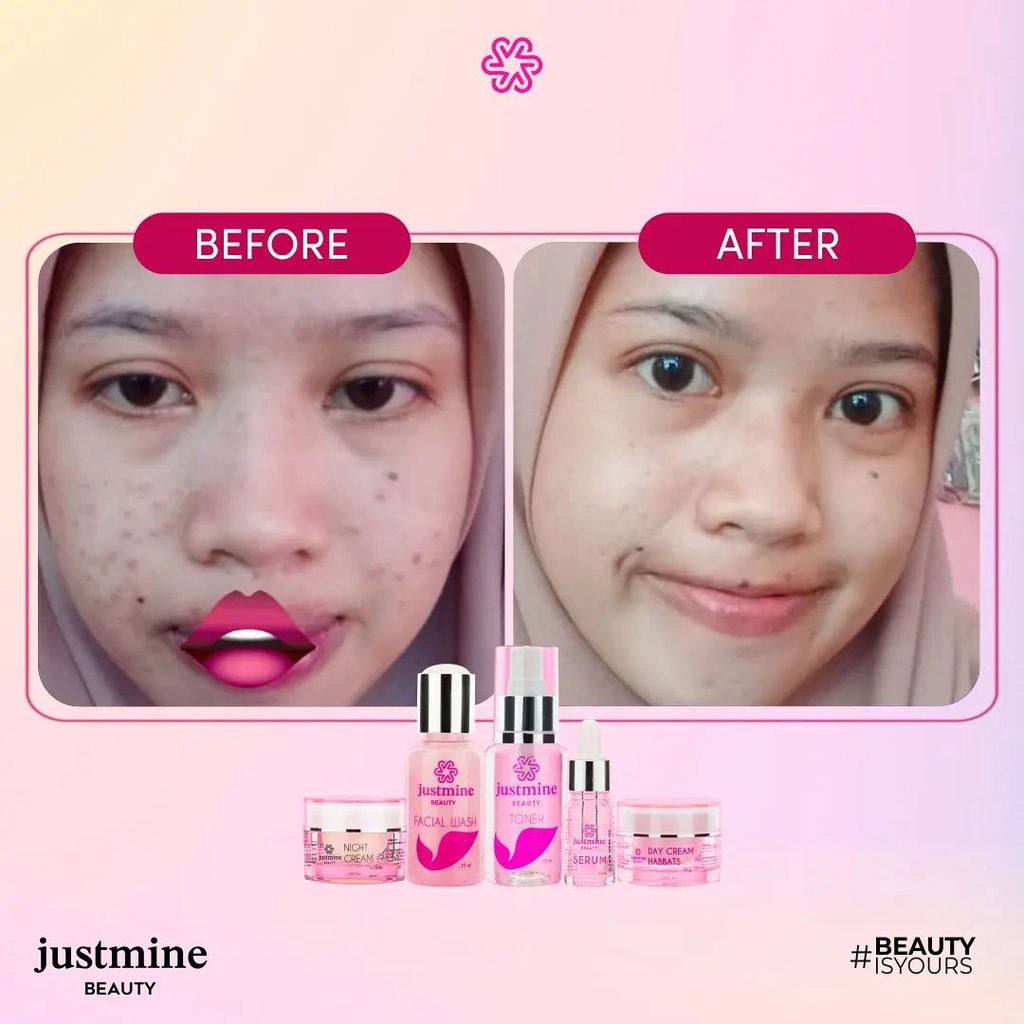Justmine Beauty Skincare Paket Skincare isi 4 All Varian Series Untuk Semua Jenis Kulit