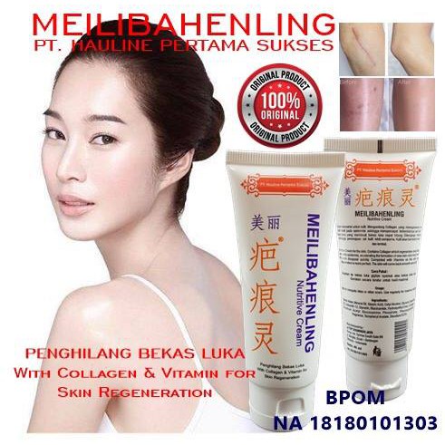 [100% Asli] MEILIBAHENLING Obat Jerawat - Meilibahenling Penghilang Bekas Luka Jerawat / Luka Koreng