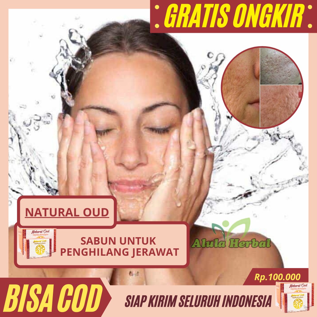 Sabun Jerawat Batu Punggung Penghilang Bopeng Anti Bakteri Alami Herbal Natural Oud Original Shopee Indonesia