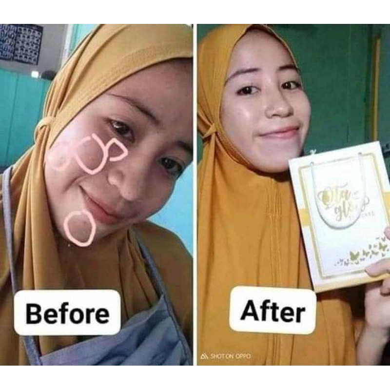 Qta glow skincare