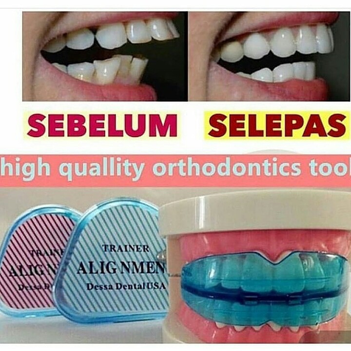 TEETH TRAINER ALIGNMENT - BEHEL GIGI PLASTIK PRAKTIS