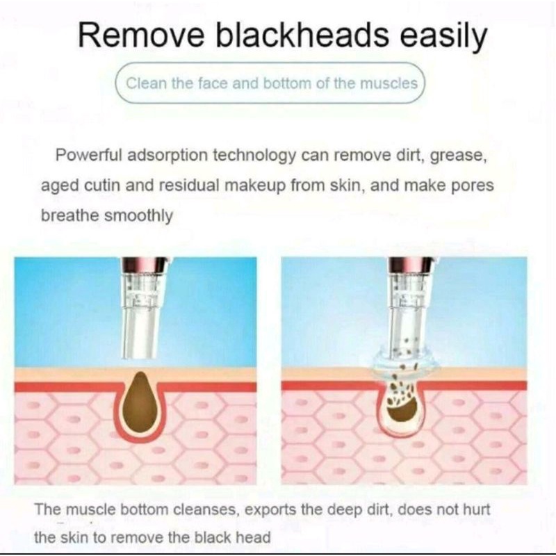 Alat Pembersih dan Penyedot Komedo / Alat Vakum Komedo / Alat Sedot Komedo / Blackhead Remover / Alat Facial Komedo / Alat Pembersih Komedo Praktis / Alat Menghilangkan Komedo Ampuh / Alat Penyedot Komedo / Alat Pembersih Wajah / Alat Membersihkan Komedo