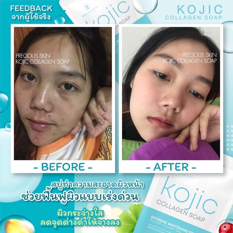 Precious Skin Kojic Paket 2 in 1 Lotion + Soap