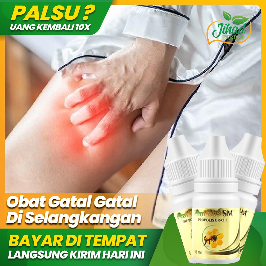 Obat Gatal Gatal Selangkangan, Gatal di Seluruh Tubuh - Propolis Brazil 6ml