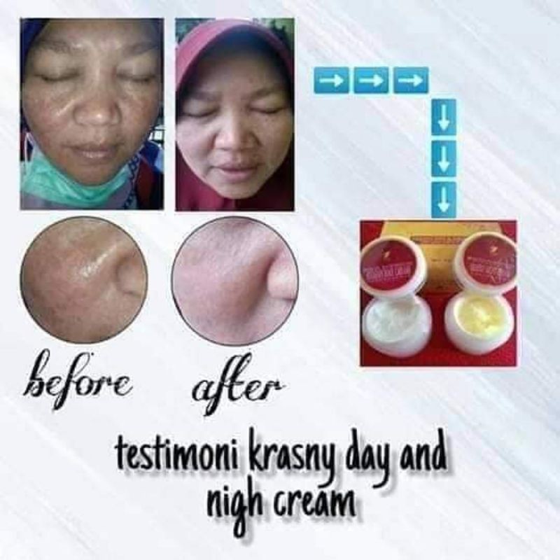 SR12 Krasny Day and Night Cream Set Krim Siang Malam SPF25 Anti Aging Penuaan Dini Mencerahkan Menghilangkan Bintik Hitam Mengobati Jerawat Bisa Untuk Jenis Kulit Kering